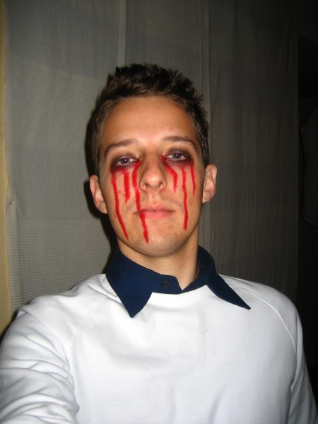 Bleeding Eyes
